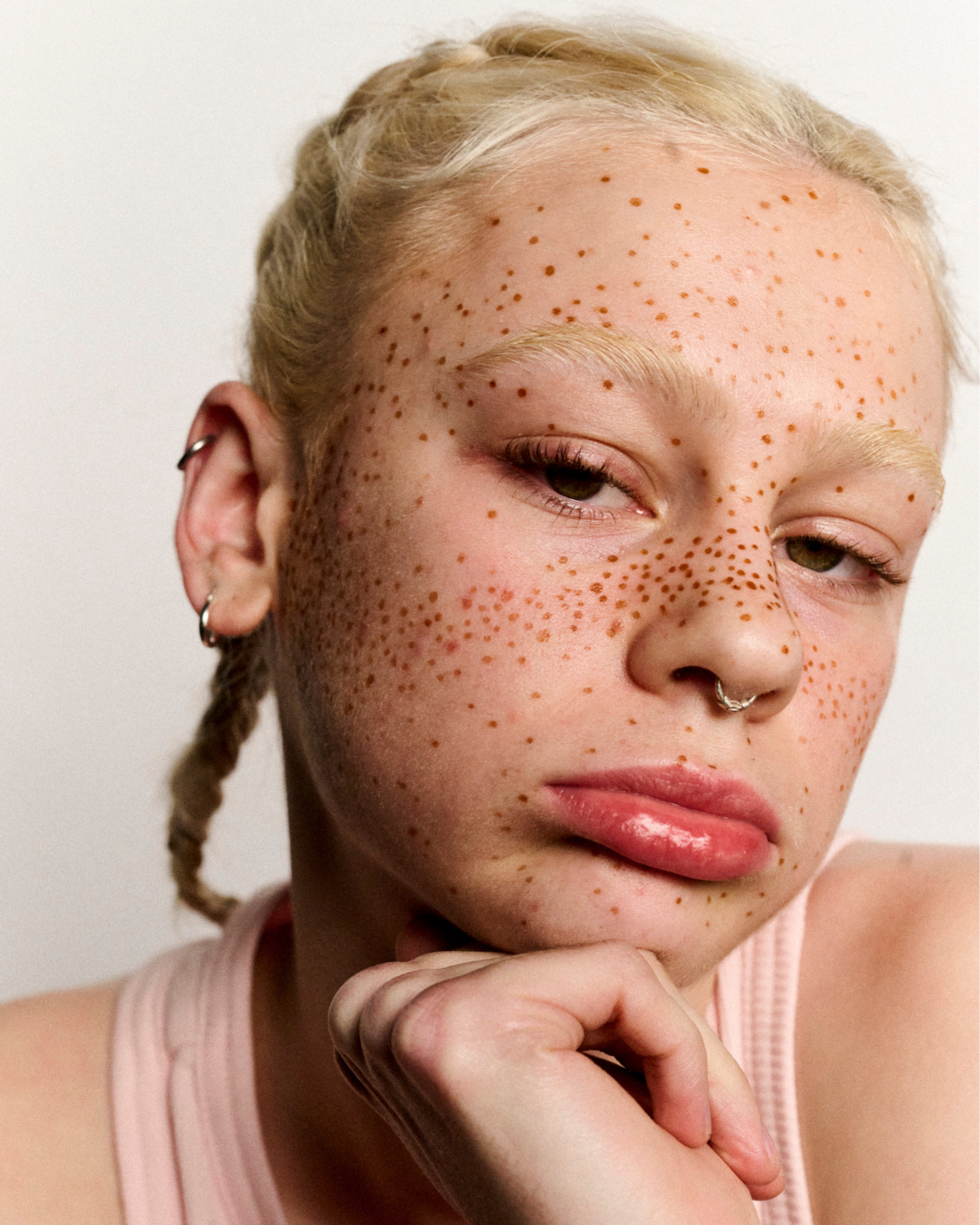 How do you fix a damaged skin barrier? Mostly by doing less.