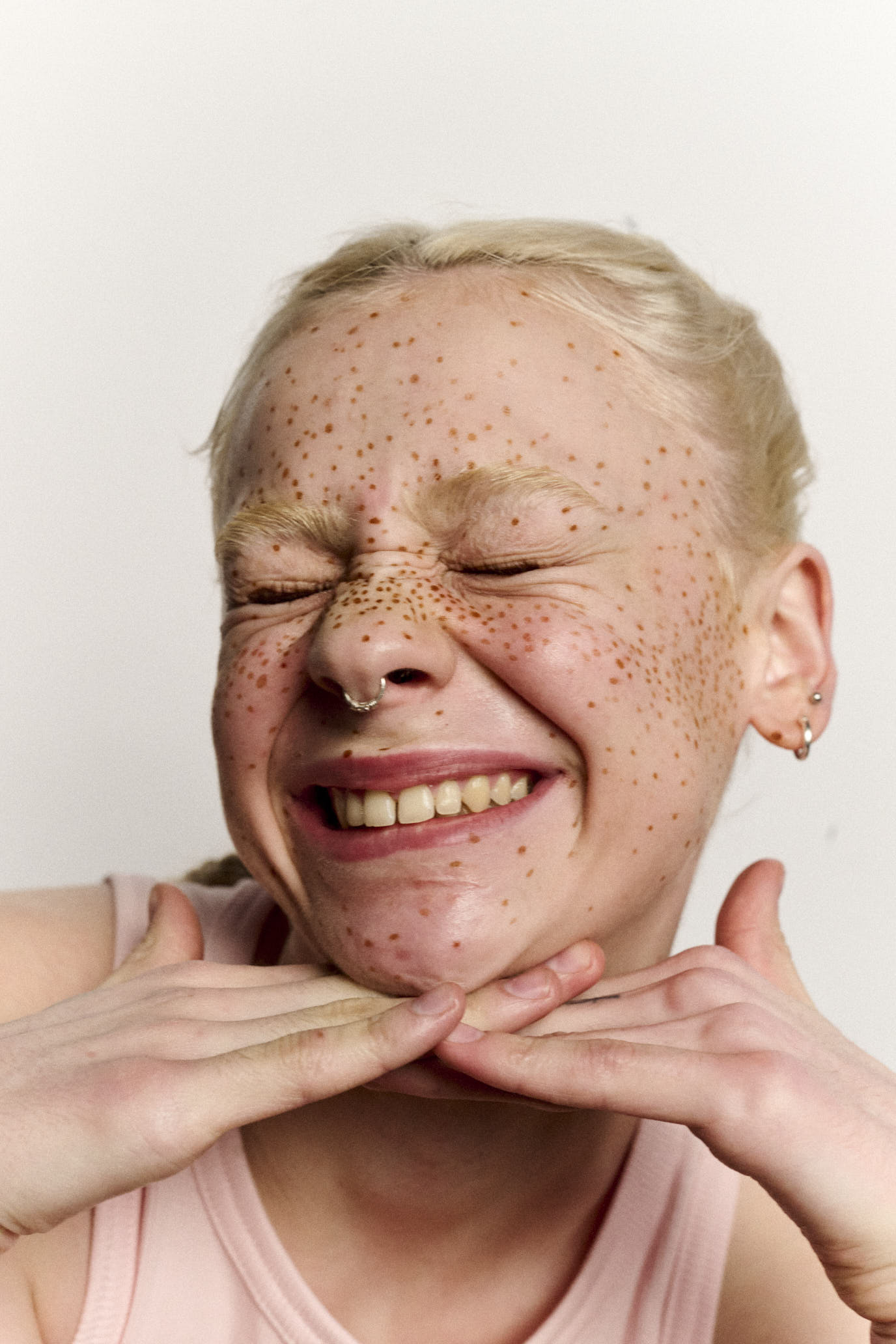 Person with freckles smiling with hands on chin against a plain background