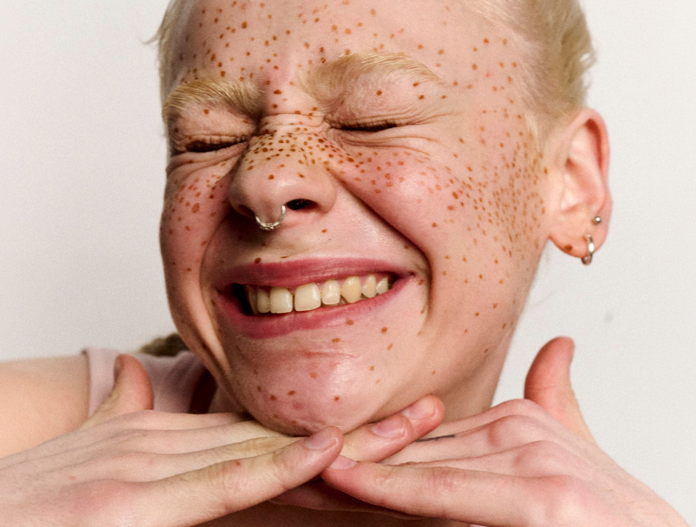 Person with freckles smiling with hands on chin against a plain background