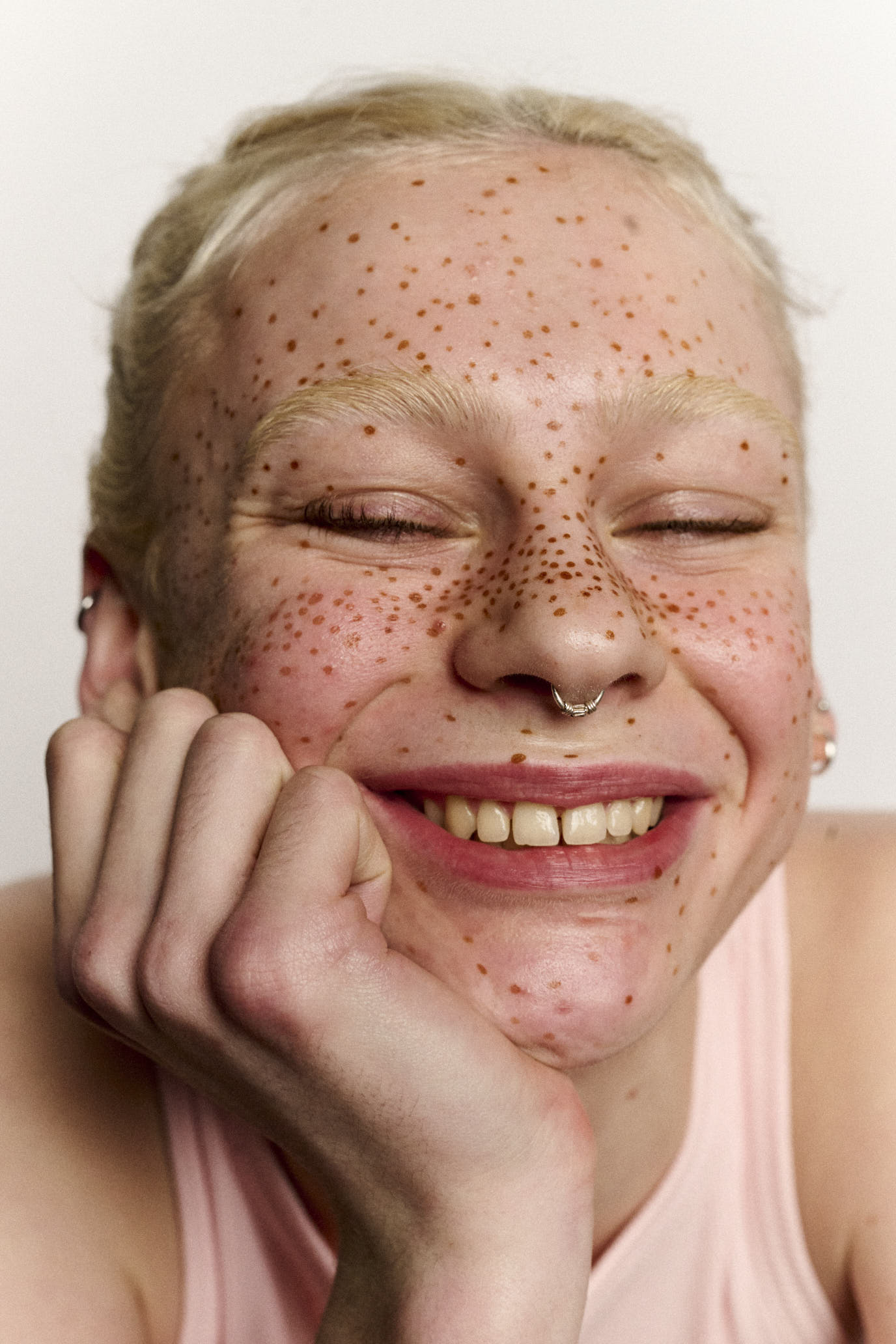 Person with freckles smiling with hand on chin against a plain background